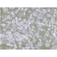 CHP-212人腦神經母細胞瘤細胞