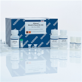 69504 69506DNeasy Blood & Tissue Kit試劑