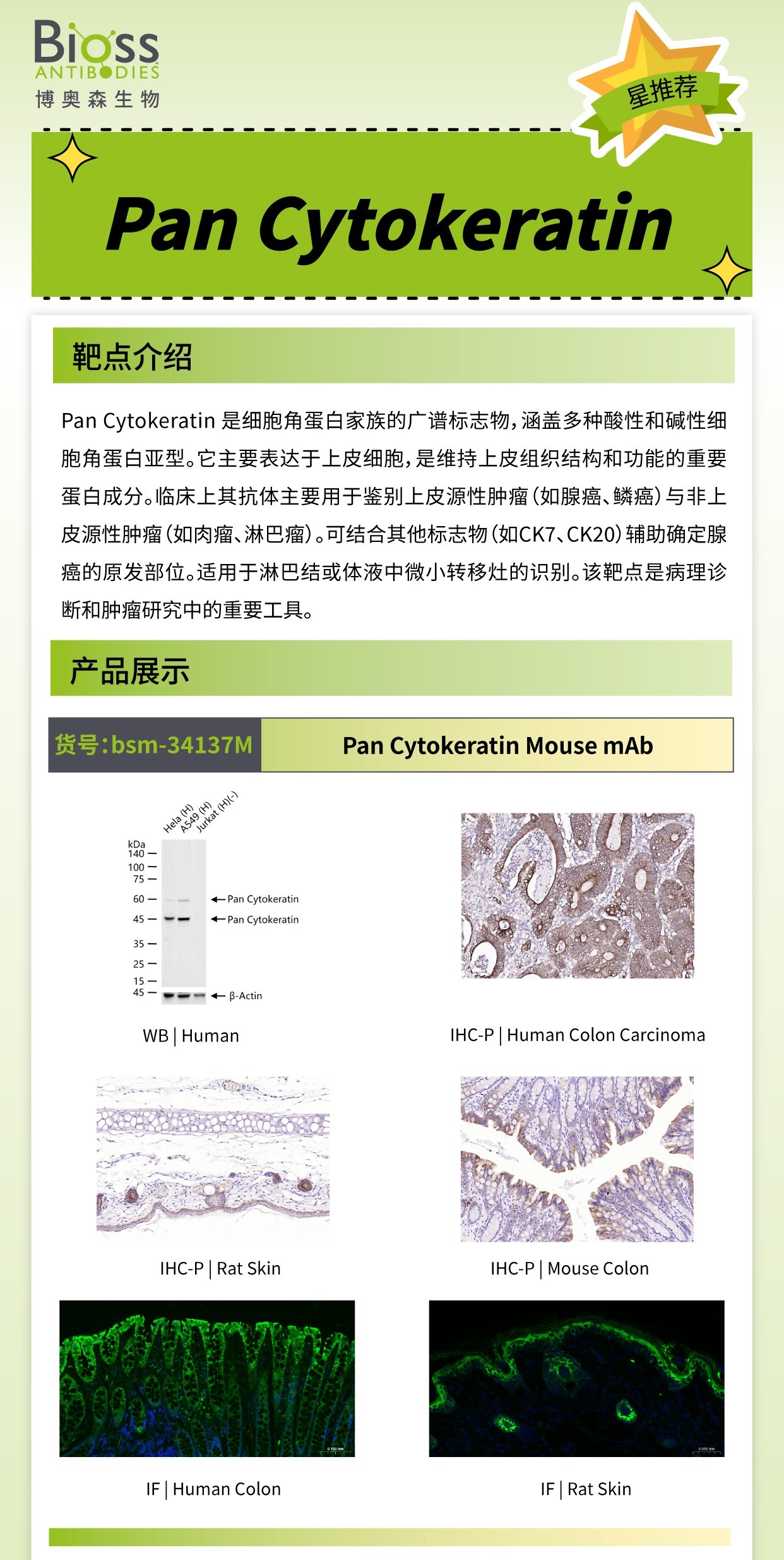 Pan Cytokeratin v1.jpg Pan Cytokeratin v1.jpg