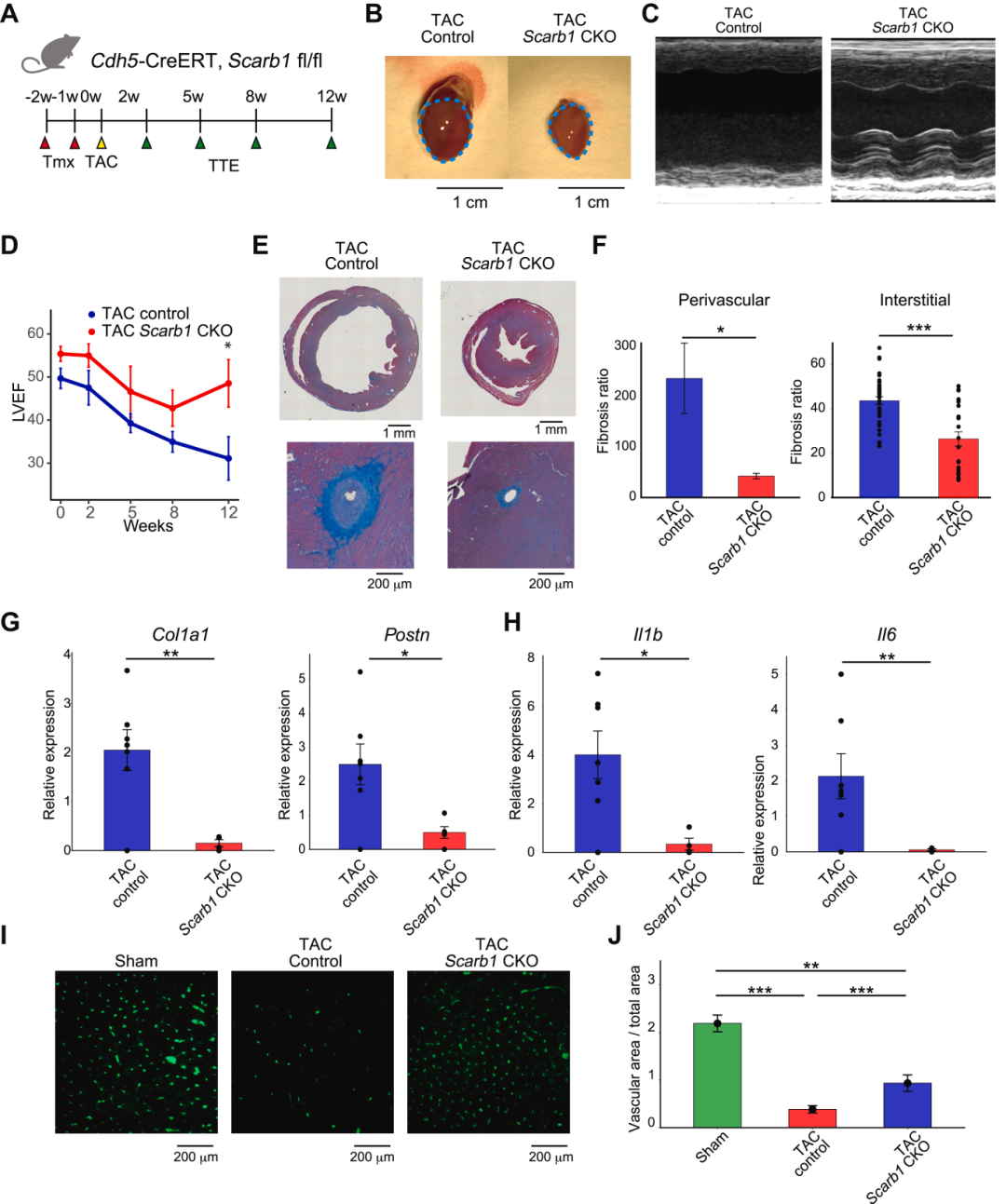 抑制内皮细胞 Scarb1 可减轻压力超负荷诱导的心力衰竭进展