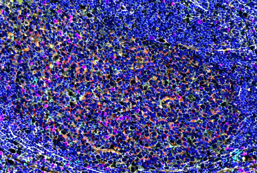北京索萊寶科技正式部署明虹CmTSA空間蛋白組學(xué)平臺(tái)