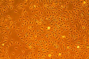 LONZA原代人冠狀動(dòng)脈內(nèi)皮細(xì)胞HCAEC 產(chǎn)品介紹